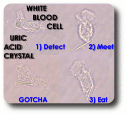 Uric Acid